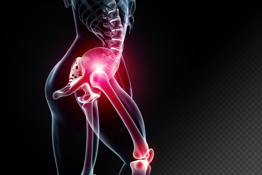 רצפת אגן חלשה